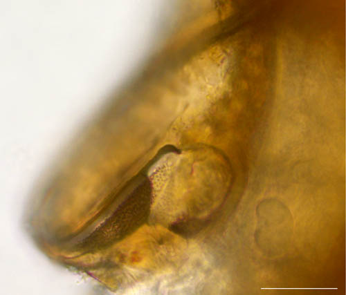 ハエダニ属の1種 (Macrocheles sp.C)