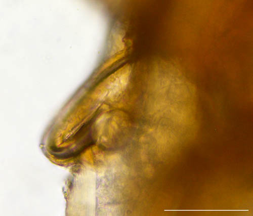 ハエダニ属の1種 (Macrocheles sp.C)