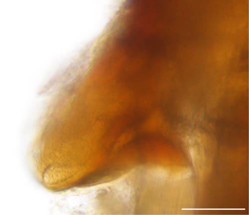 スギタテハエダニ（Macrocheles punctatus）