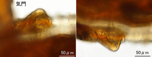 クチナガハエダニ属の1種（Holostaspella sp.B
