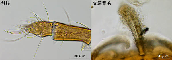 クチナガハエダニ属の1種（Holostaspella sp.B