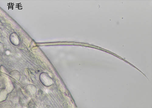 ホコダニ属の1種(Holaspina sp.A)
