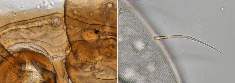 ホコダニ属の1種(Holaspina sp.A)