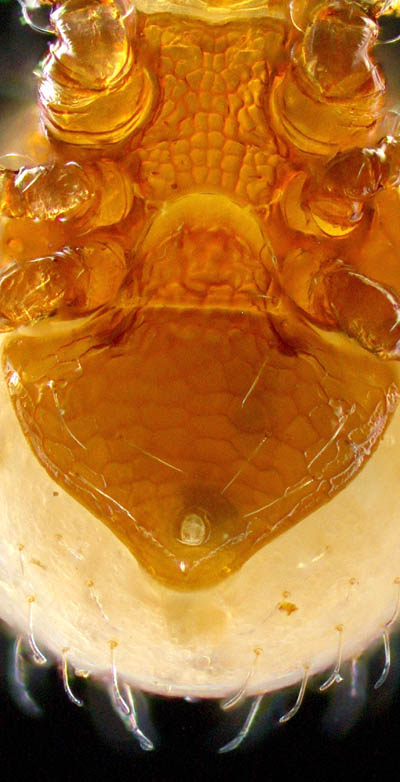 ホコダニ科の1種（分類群03）