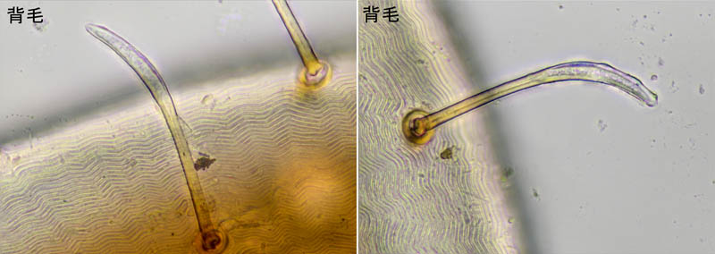 ホコダニ科の1種（分類群03）