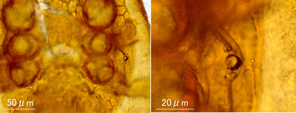 ホコダニ科の1種（分類群04）