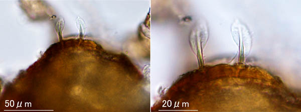 ホコダニ科の1種（分類群04）