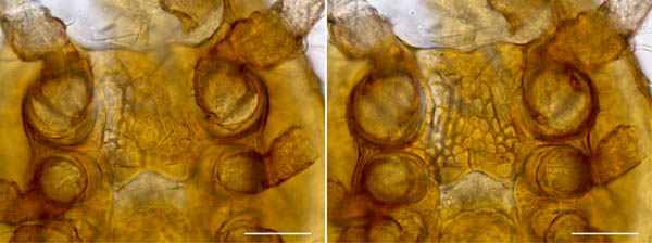 ホコダニ科の1種（分類群04）
