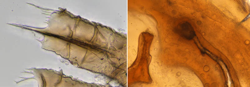 ホコダニ属の1種(Holaspina sp.B)