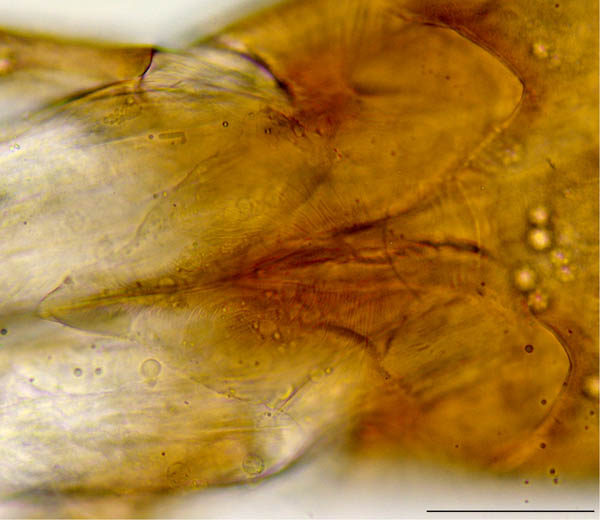 コシビロホコダニ属の1種（Neparholaspis sp.A）