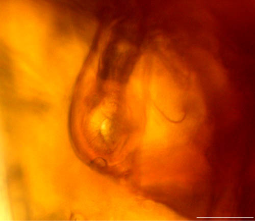 コシビロホコダニ属の1種（Neparholaspis sp.A）