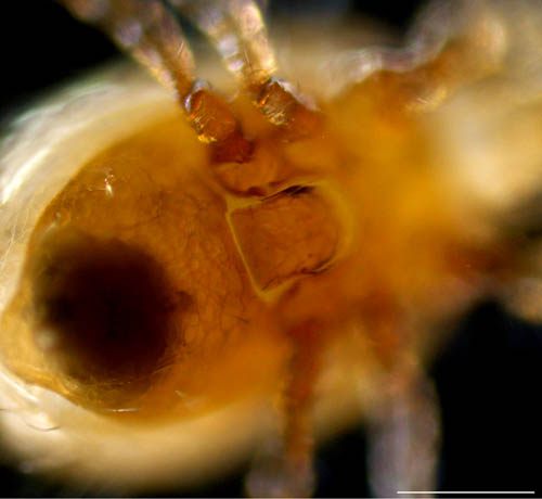 コシビロホコダニ属の1種（Neparholaspis sp.A）