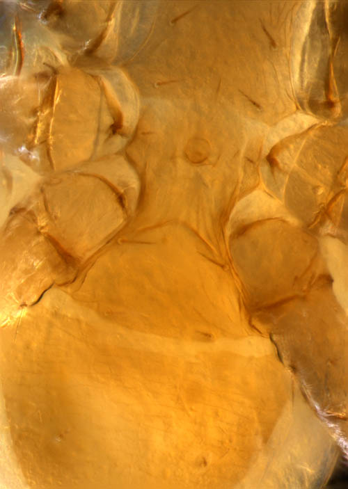 キツネダニ科(Veigaiidae）の1種