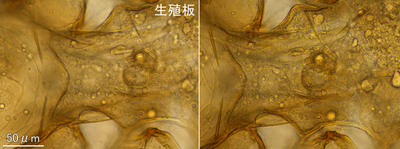 キツネダニ科(Veigaiidae）の1種