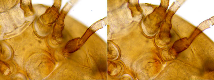 ツブトゲダニ科(Ologamasidae)の1種