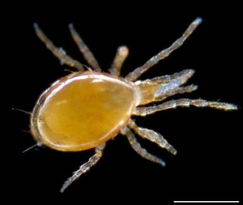 ツブトゲダニ科(Ologamasidae)の1種