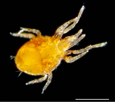 ツブトゲダニ科(Ologamasidae)の1種