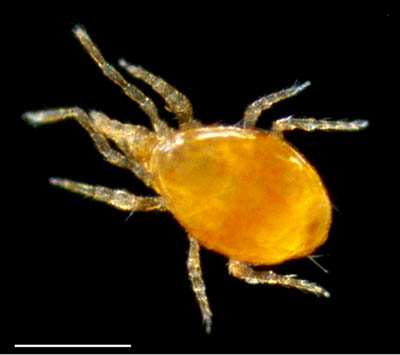 ツブトゲダニ科(Ologamasidae)の1種