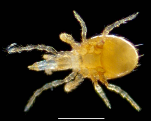 ツブトゲダニ科(Ologamasidae)の1種