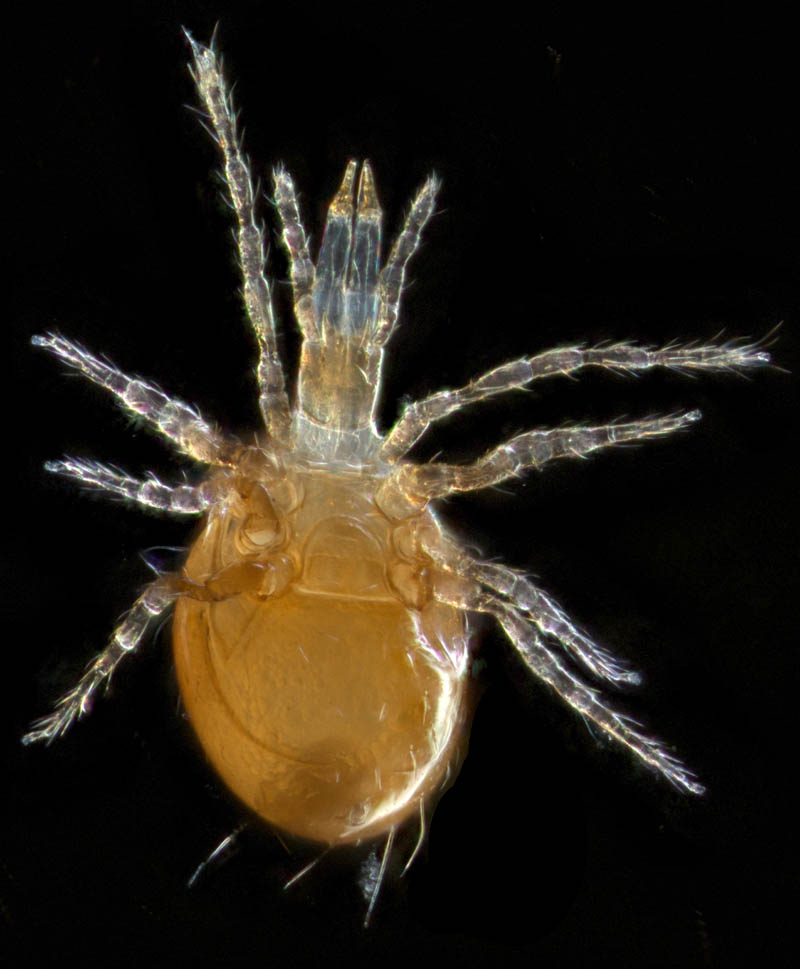 ツブトゲダニ科(Ologamasidae)の1種