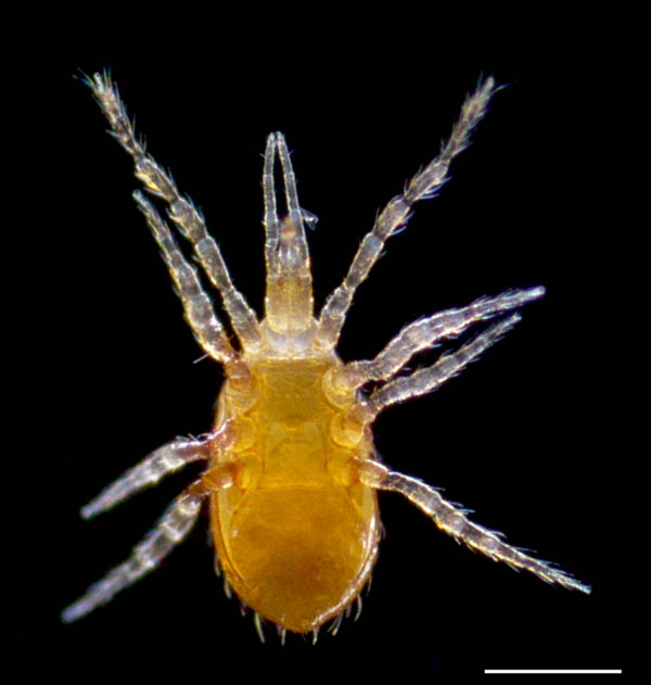 ツブトゲダニ科(Ologamasidae)の1種