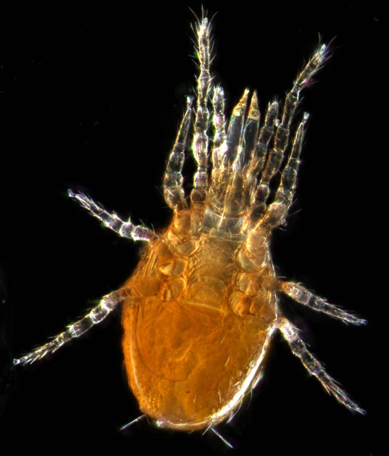 ツブトゲダニ科(Ologamasidae)の1種