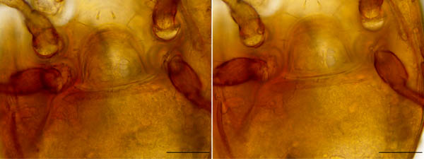 ツブトゲダニ科(Ologamasidae)の1種