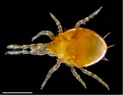 ツブトゲダニ科(Ologamasidae)の1種