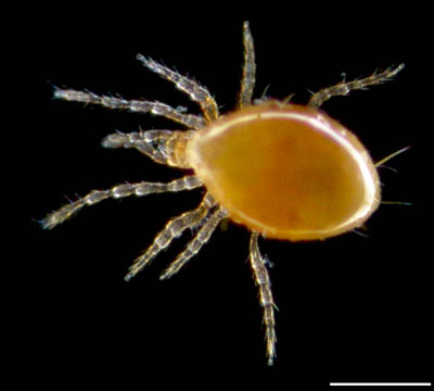 ツブトゲダニ科(Ologamasidae)の1種