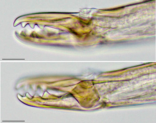 ツブトゲダニ科(Ologamasidae)の1種
