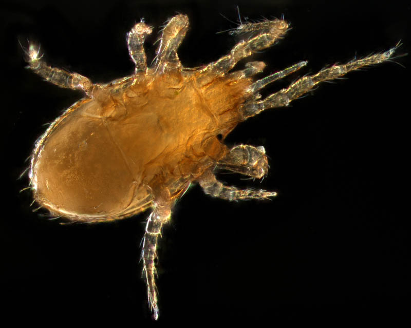 ツブトゲダニ科(Ologamasidae)の1種