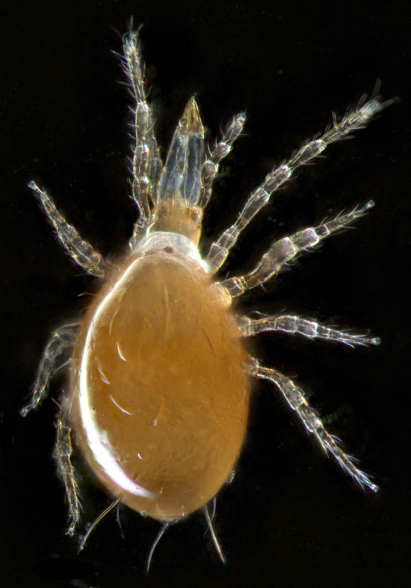 ツブトゲダニ科(Ologamasidae)の1種