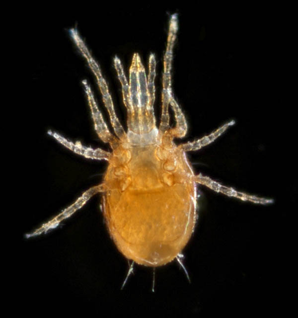 ツブトゲダニ科(Ologamasidae)の1種