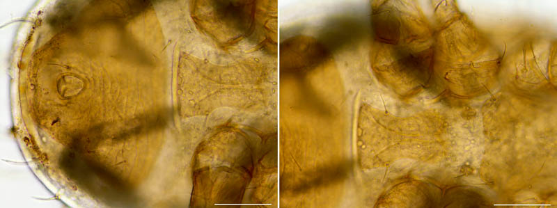 ホソスカシダニ属の1種（Lasioseius sp.）