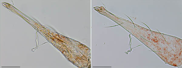 ケモチテングダニ属の1種（Neomolgus sp.）