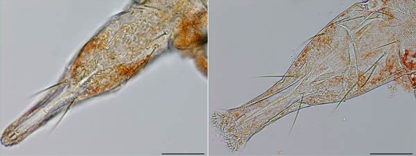 ケモチテングダニ属の1種（Neomolgus sp.）