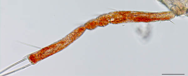 ケモチテングダニ属の1種（Neomolgus sp.）