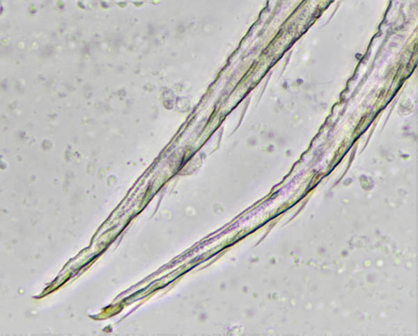 ツチトビムシ科の1種　（Isotomidae gen. sp.）